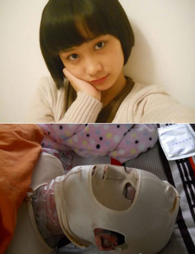 Combination photos show Zhou before and after she was disfigured in an attack. Probe into teen's crime resumes