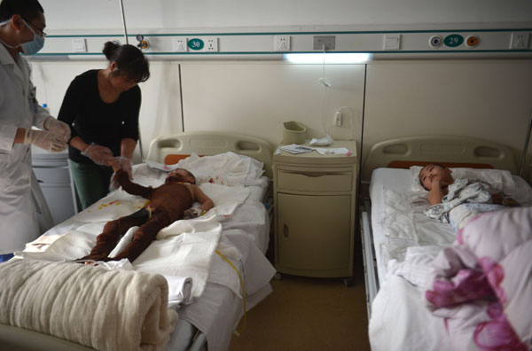 Brothers burned by boy while copying TV scene