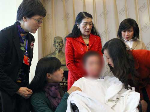 全國政協(xié)委員聯(lián)名提案呼吁加大毀容案件懲罰力度