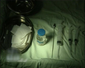 部分消費(fèi)者美容整形注射奧美定引發(fā)癌癥