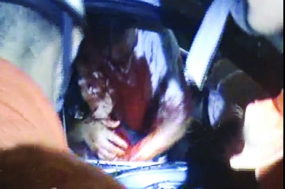 車禍中丈夫拒絕治療 爬回車內(nèi)人工呼吸救妻子(圖)