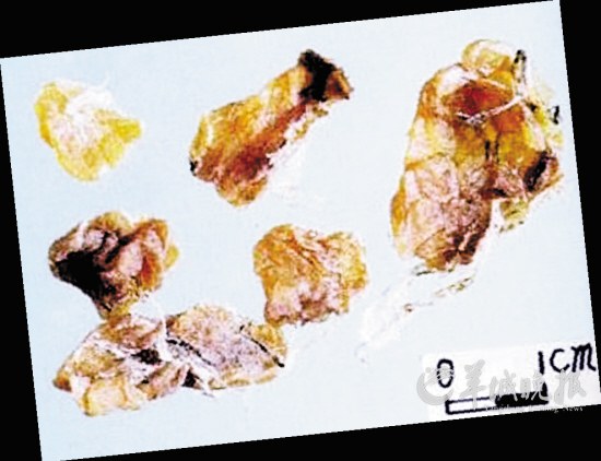 盤(pán)點(diǎn)動(dòng)物糞便的奇妙用途