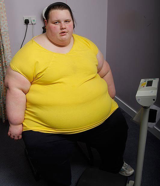 盤點全球令人無法想象的胖人