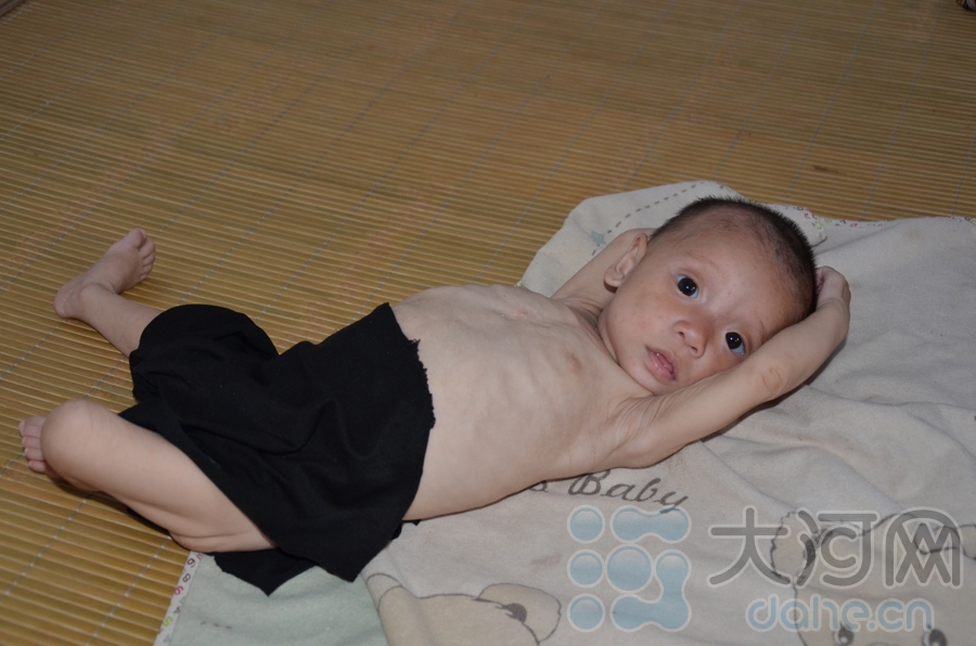 饑餓娃娃愛(ài)心賬戶開(kāi)通 全國(guó)合力不讓悲劇再重演(圖)