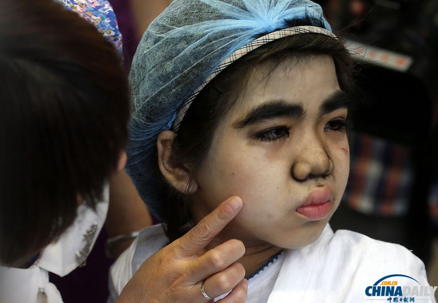 杭州:10歲輟學(xué)“毛孩”受關(guān)愛 接受面部激光脫毛