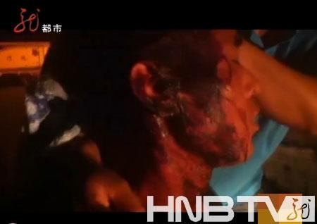 哈爾濱城管部門稱打傷瓜販城管是“臨時(shí)工”