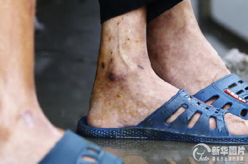 陜西一殘疾人托養(yǎng)院給老人戴鐵鏈 稱家屬同意(圖)