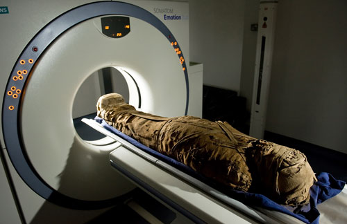 倫敦千年木乃伊X光“檢查身體”