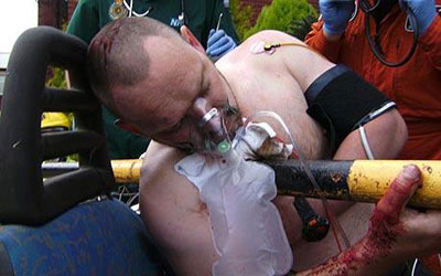 英司機被鐵桿穿胸 鎮(zhèn)定報警救援及時奇跡生還