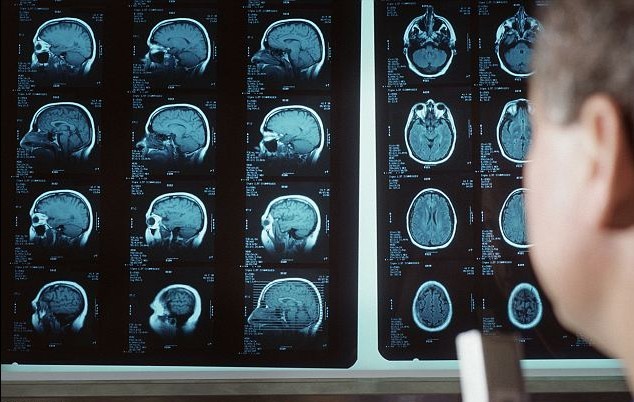 美政府?dāng)M繪制人腦活動圖 十年或耗資數(shù)十億美元