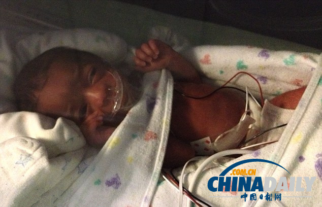 美夫婦生下雙胞胎后又迎來(lái)五胞胎