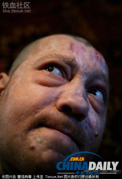 美麗蛻變!實拍吸毒女孩的戒毒歷程