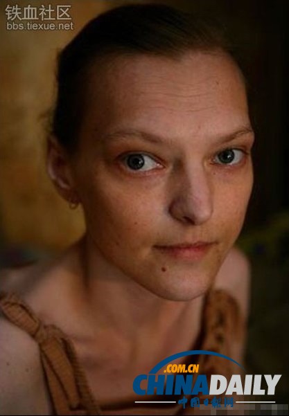 美麗蛻變！實拍吸毒女孩的戒毒歷程