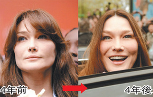 法國(guó)第一夫人被疑整形過度