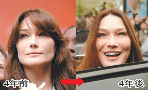 圖：法國第一夫人被指容顏大變 疑整形過度