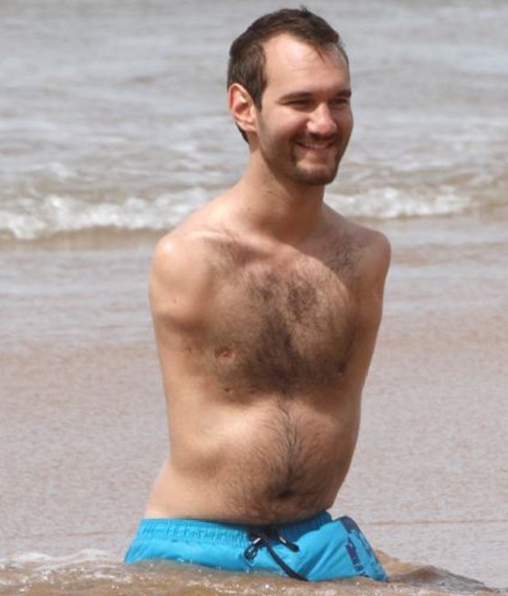 沒(méi)有四肢生活也很精彩！澳勵(lì)志哥夏威夷享受浪漫蜜月