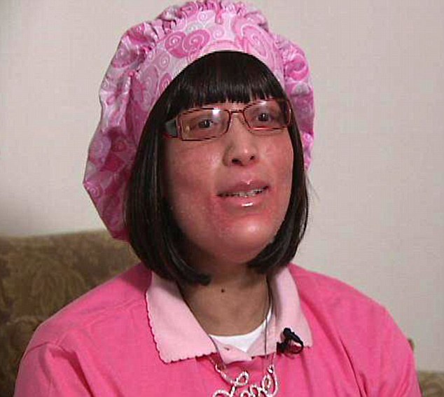 美女子全身不長毛發(fā)長指甲 屬世界首例醫(yī)學(xué)界尚無解