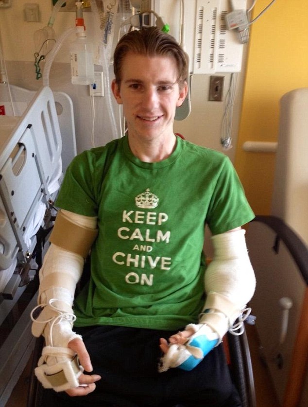 美大兵成功接受雙臂移植手術(shù) 失去四肢頑強生存事跡鼓舞眾人