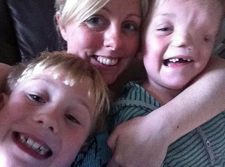 英國(guó)男童天生“半臉” 同胞兄弟情令人動(dòng)容