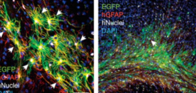 美培育“人腦老鼠” 或可啟發(fā)神經疾病新療法