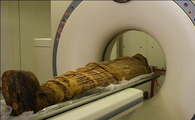 木乃伊也患動(dòng)脈硬化 神奇儀器助心臟病人“復(fù)生”