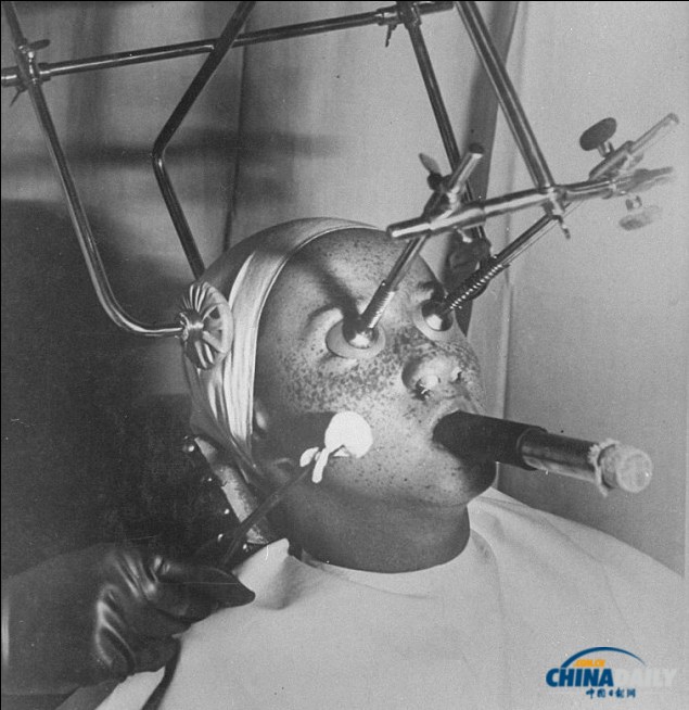 加熱美膚帽、冰凍祛斑機 圖說上世紀(jì)“恐怖”美容法