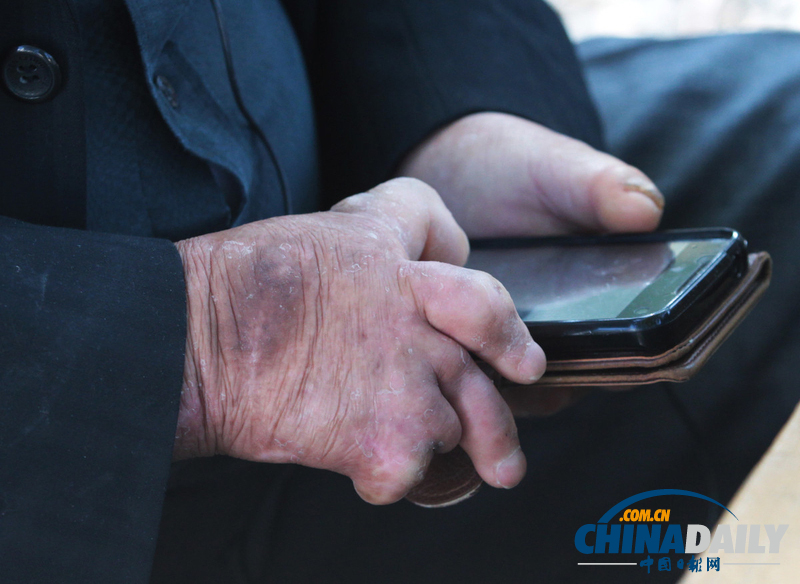 歷史遺留之痛：走近韓國小鹿島麻風(fēng)病院