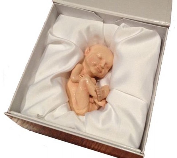 3D打印帶你見(jiàn)未出生胎兒!體位表情皮膚性別皆可見(jiàn)