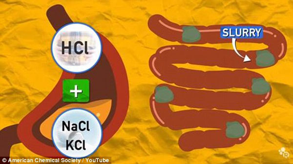口香糖粘腸子？可被排出體外