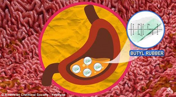 口香糖粘腸子？可被排出體外