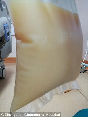 中山男子腹痛緊急送醫(yī)搶救，檢出“牛奶血”！