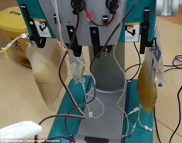 中山男子腹痛緊急送醫(yī)搶救，檢出“牛奶血”！