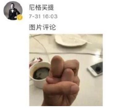 一般人做不出的張一山秋水誓？醫(yī)生：這是?。? style=