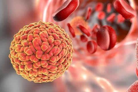 研究:寨卡病毒或可治療腦癌