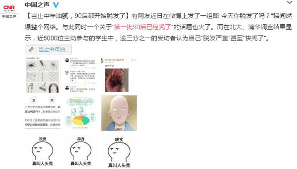 拿什么拯救90后的發(fā)際線？別急，科學家找到辦法啦