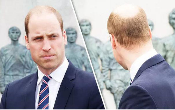 拿什么拯救90后的發(fā)際線？別急，科學家找到辦法啦