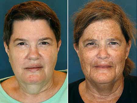 皮膚老化？生活習(xí)慣惹的禍