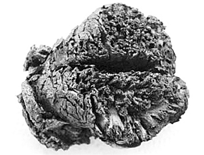 最古老的人腦緣何4000年不朽?